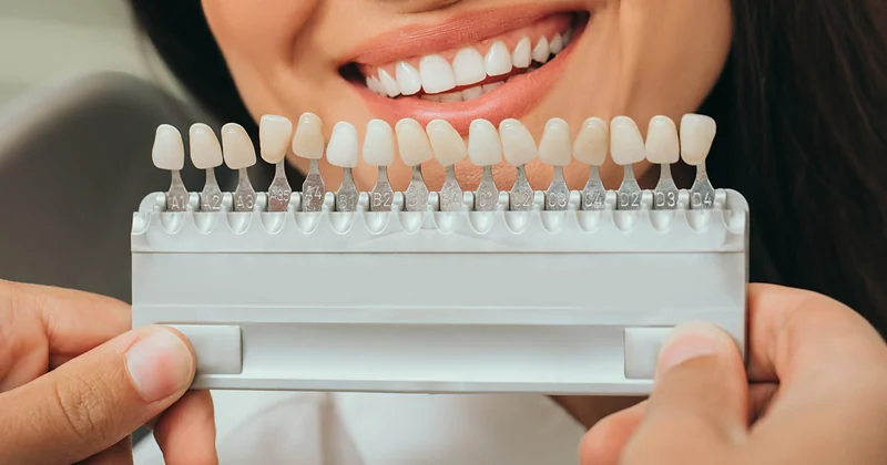 A professional whitening tray and gel syringe on soft linen