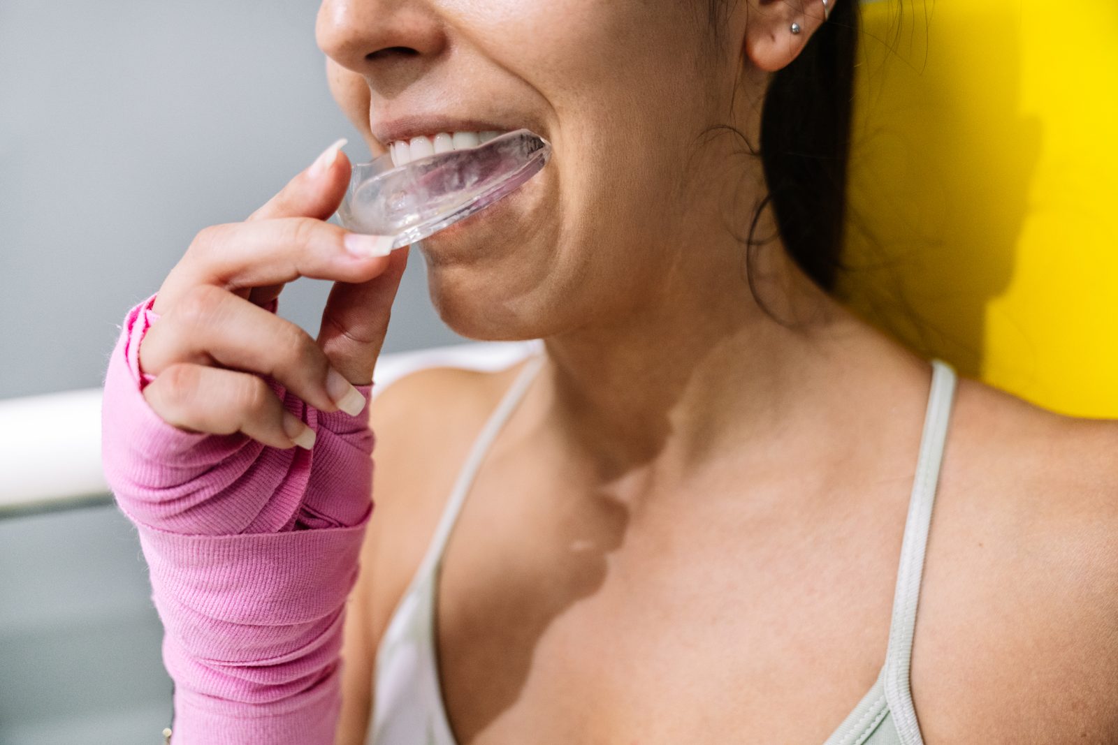 Custom Mouth Guards